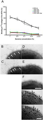 Corrigendum: The pulmonary extracellular matrix is a bactericidal barrier against Haemophilus influenzae in chronic obstructive pulmonary disease (COPD): implications for an in vivo innate host defense function of collagen VI